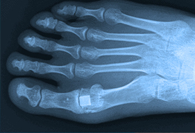 xray